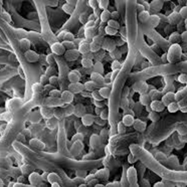 Biofilmfall Biofilmfall