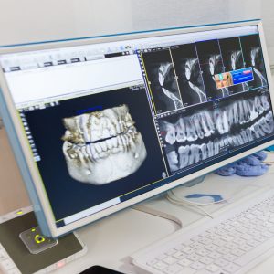 Radiation Health and Safety (RHS) DANB Exam Review for Dental Assistants